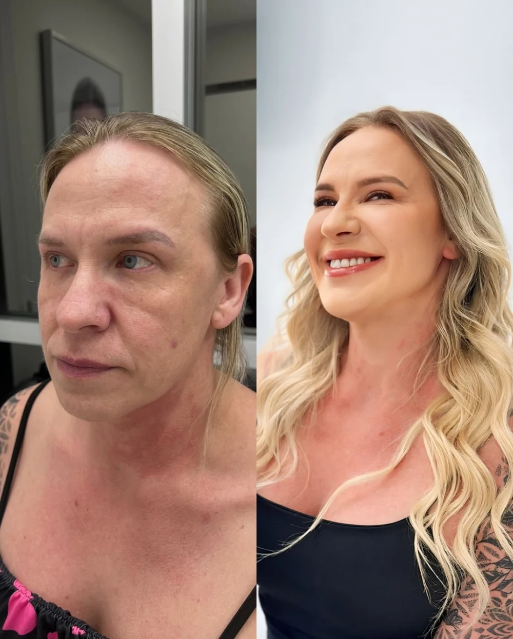 Perfeccionare Clínica de Estética